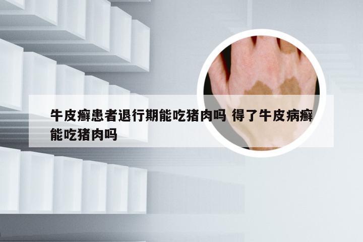牛皮癣患者退行期能吃猪肉吗 得了牛皮病癣能吃猪肉吗