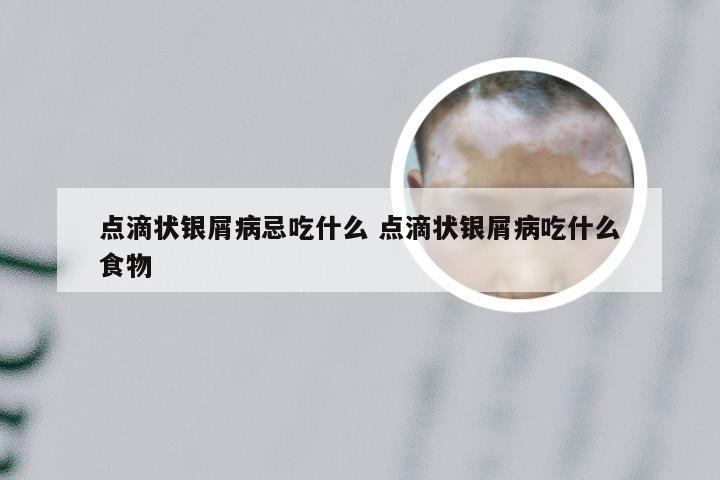 点滴状银屑病忌吃什么 点滴状银屑病吃什么食物