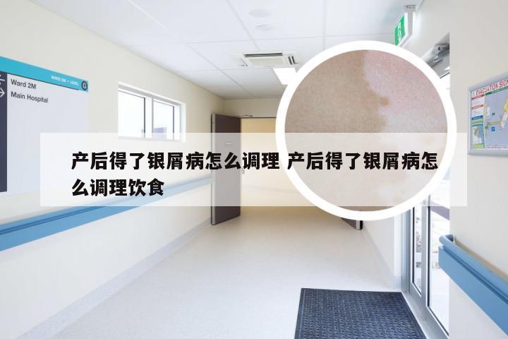 产后得了银屑病怎么调理 产后得了银屑病怎么调理饮食