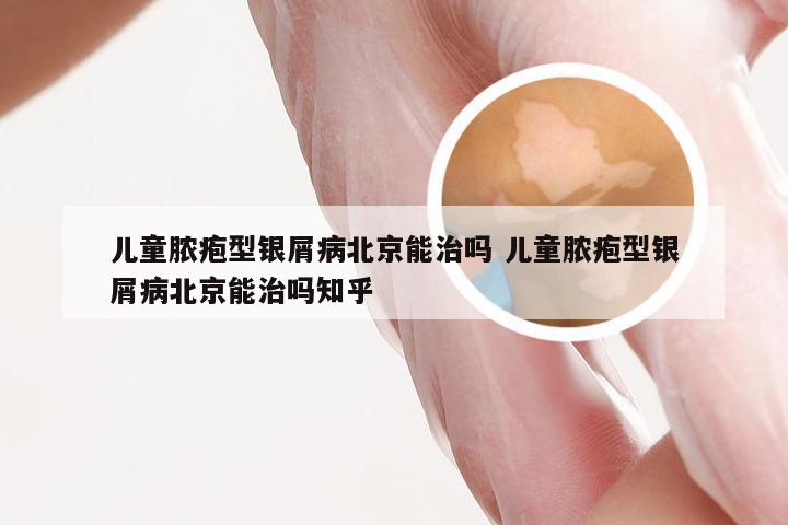 儿童脓疱型银屑病北京能治吗 儿童脓疱型银屑病北京能治吗知乎
