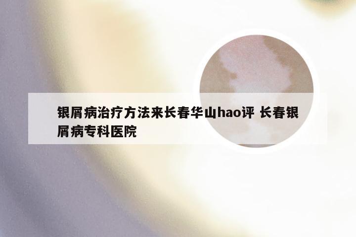 银屑病治疗方法来长春华山hao评 长春银屑病专科医院