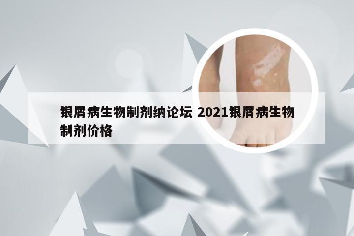 银屑病生物制剂纳论坛 2021银屑病生物制剂价格