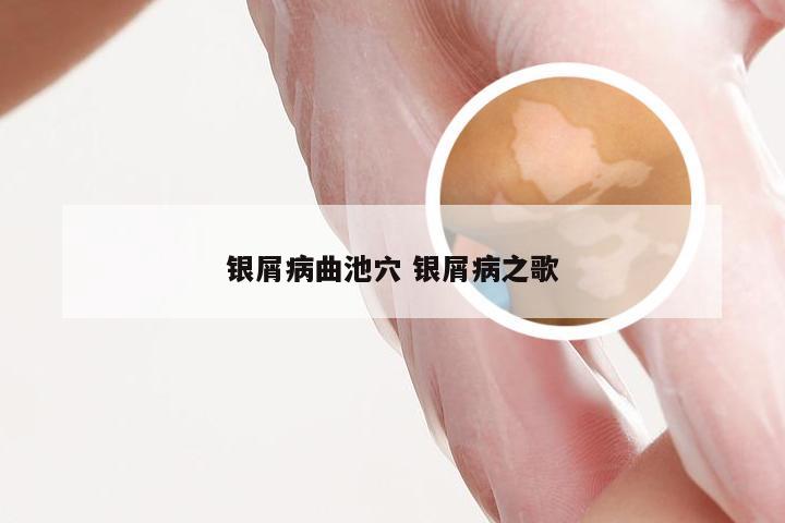 银屑病曲池穴 银屑病之歌