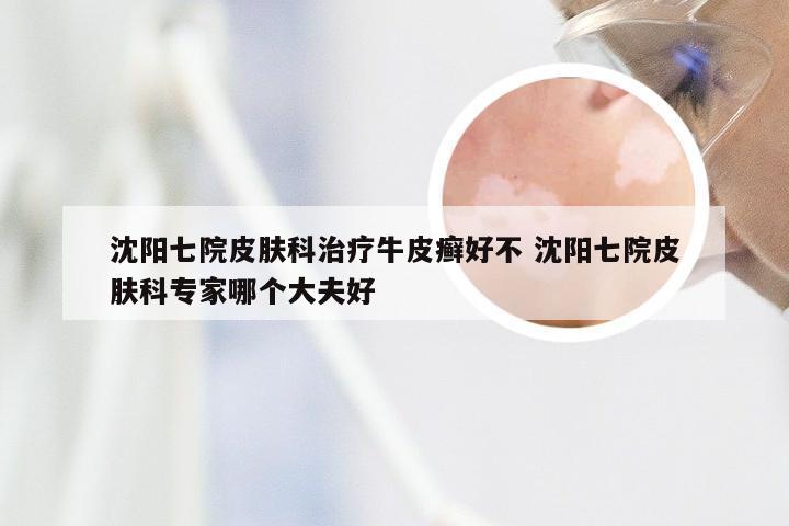 沈阳七院皮肤科治疗牛皮癣好不 沈阳七院皮肤科专家哪个大夫好