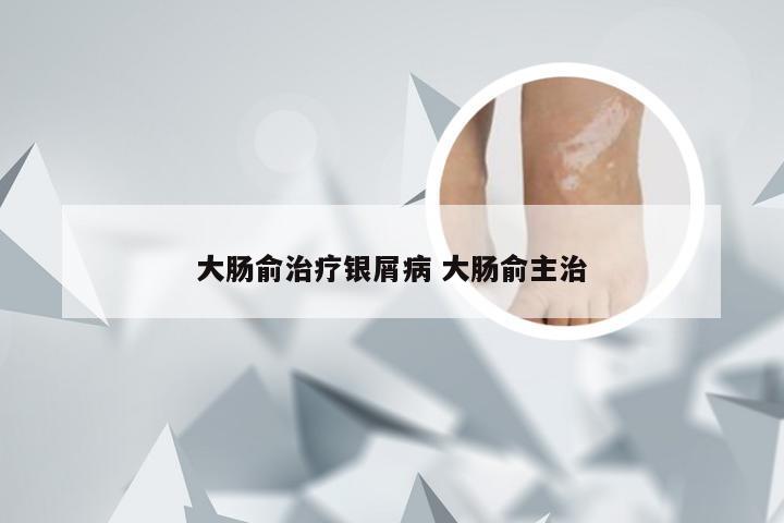 大肠俞治疗银屑病 大肠俞主治