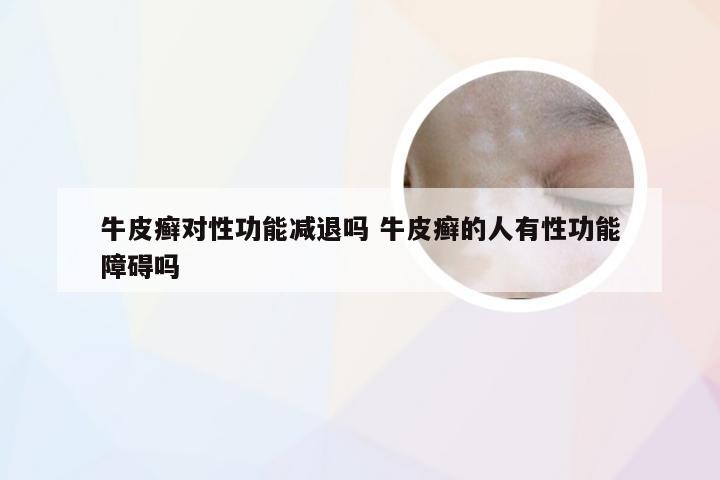 牛皮癣对性功能减退吗 牛皮癣的人有性功能障碍吗