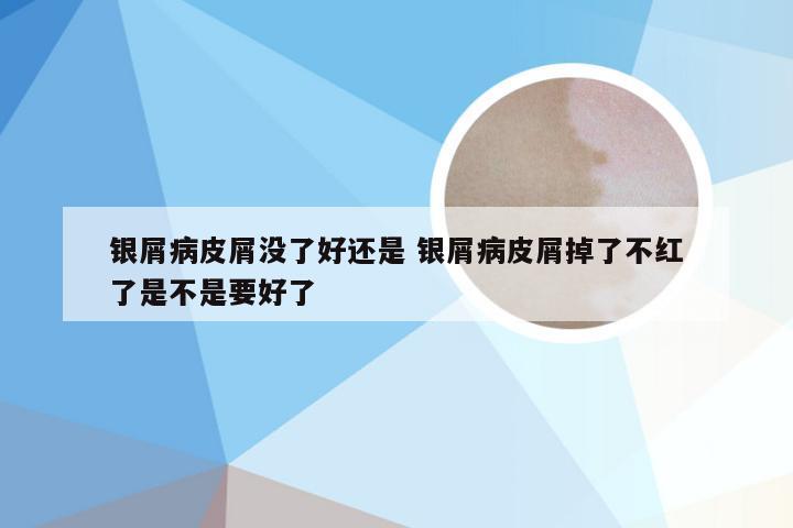银屑病皮屑没了好还是 银屑病皮屑掉了不红了是不是要好了