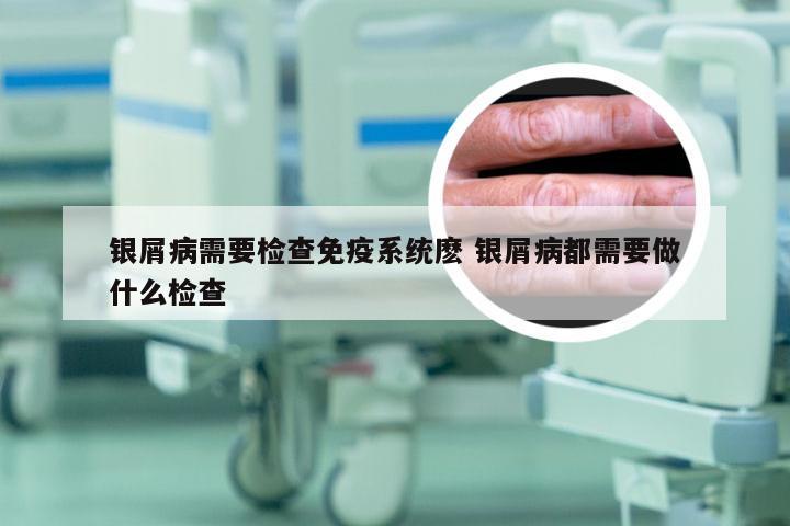 银屑病需要检查免疫系统麽 银屑病都需要做什么检查
