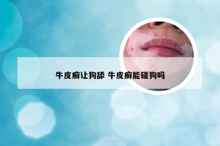 牛皮癣让狗舔 牛皮癣能碰狗吗