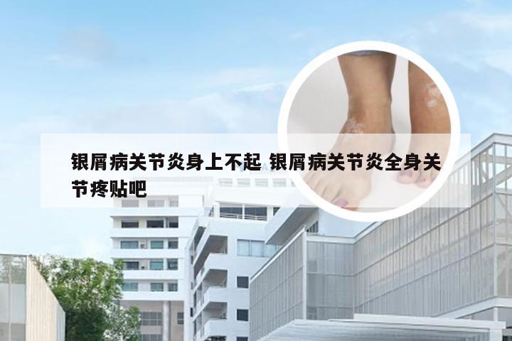 银屑病关节炎身上不起 银屑病关节炎全身关节疼贴吧