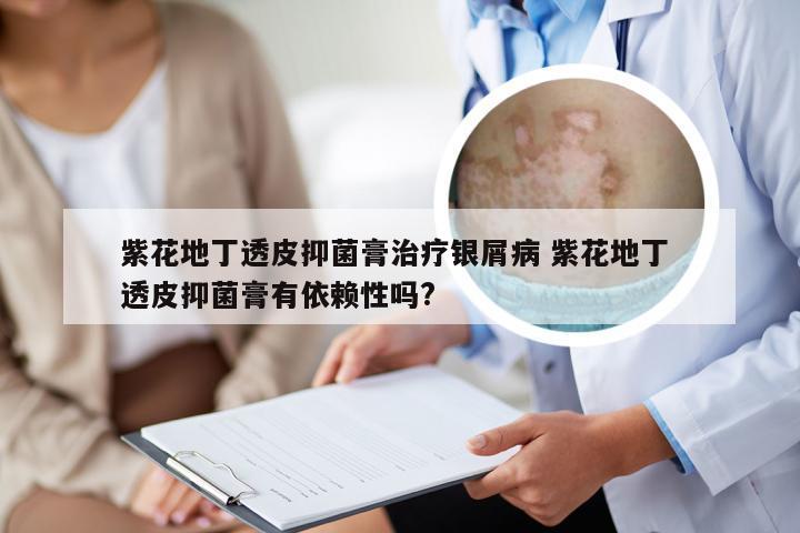 紫花地丁透皮抑菌膏治疗银屑病 紫花地丁 透皮抑菌膏有依赖性吗?