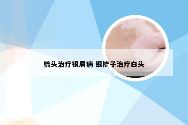 梳头治疗银屑病 银梳子治疗白头
