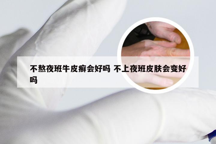 不熬夜班牛皮癣会好吗 不上夜班皮肤会变好吗