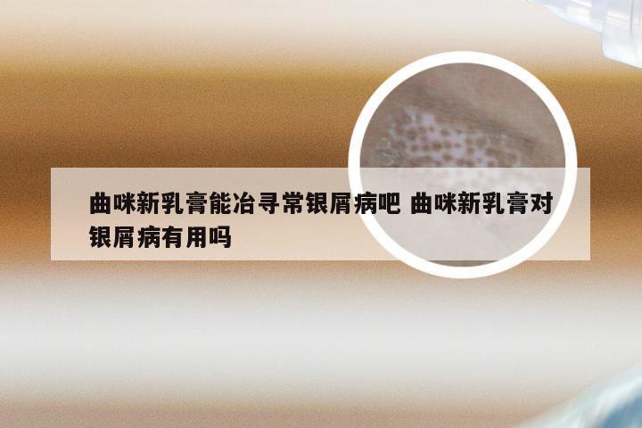 曲咪新乳膏能冶寻常银屑病吧 曲咪新乳膏对银屑病有用吗