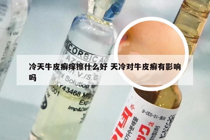 冷天牛皮癣痒擦什么好 天冷对牛皮癣有影响吗