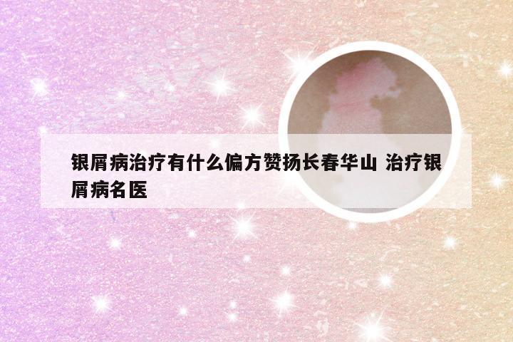 银屑病治疗有什么偏方赞扬长春华山 治疗银屑病名医