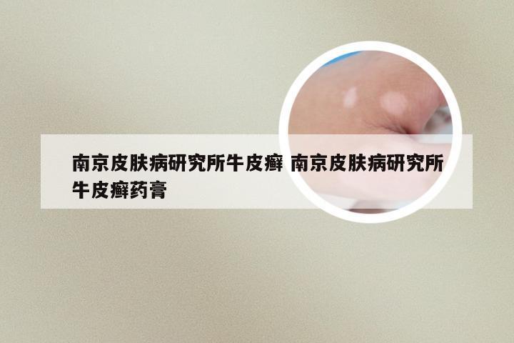 南京皮肤病研究所牛皮癣 南京皮肤病研究所牛皮癣药膏