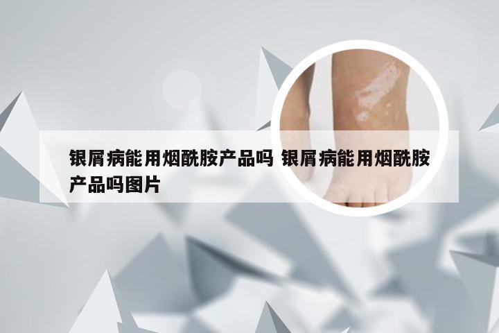 银屑病能用烟酰胺产品吗 银屑病能用烟酰胺产品吗图片