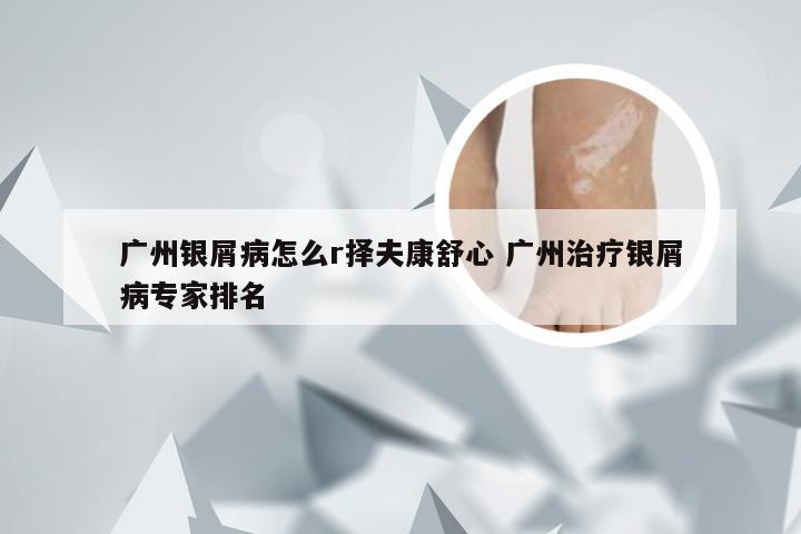 广州银屑病怎么r择夫康舒心 广州治疗银屑病专家排名