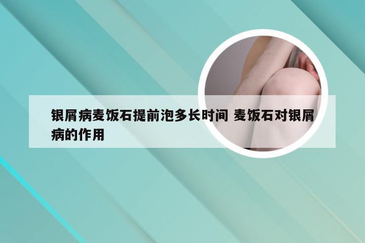 银屑病麦饭石提前泡多长时间 麦饭石对银屑病的作用