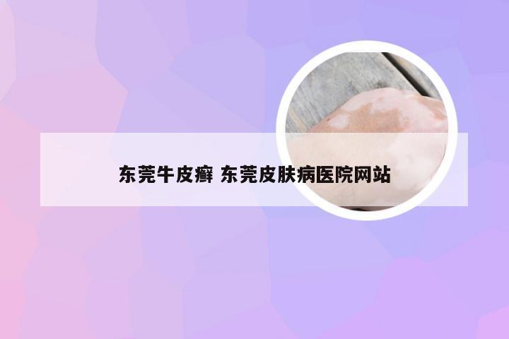 东莞牛皮癣 东莞皮肤病医院网站