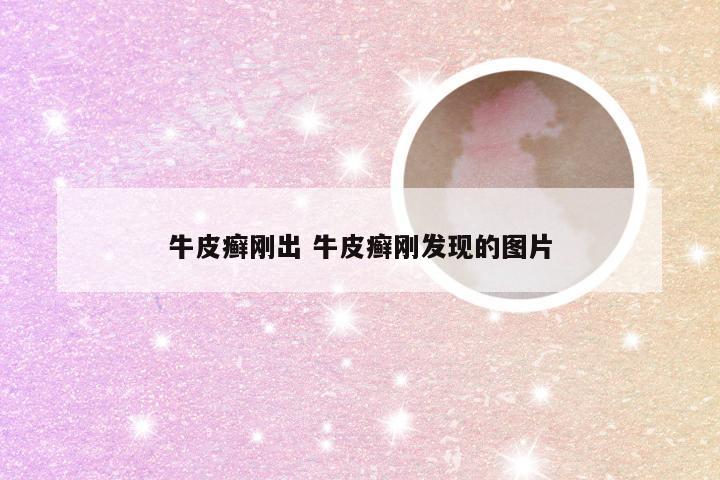 牛皮癣刚出 牛皮癣刚发现的图片