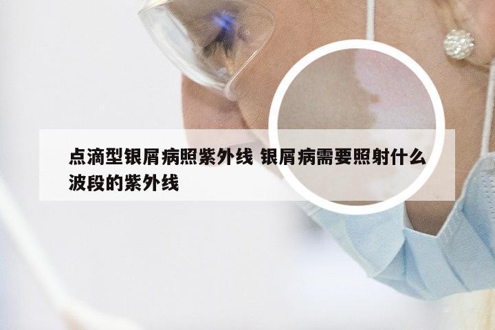 点滴型银屑病照紫外线 银屑病需要照射什么波段的紫外线