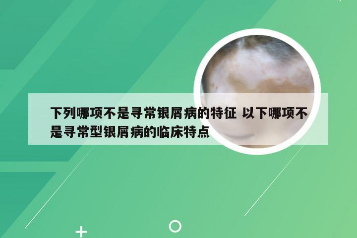 下列哪项不是寻常银屑病的特征 以下哪项不是寻常型银屑病的临床特点