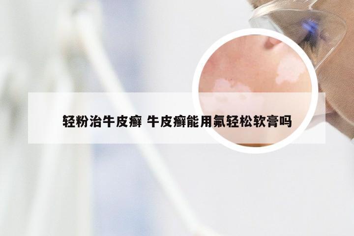 轻粉治牛皮癣 牛皮癣能用氟轻松软膏吗