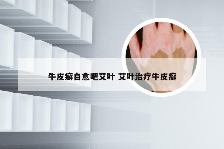 牛皮癣自愈吧艾叶 艾叶治疗牛皮癣