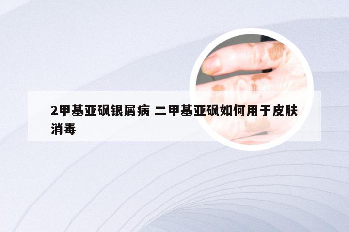 2甲基亚砜银屑病 二甲基亚砜如何用于皮肤消毒