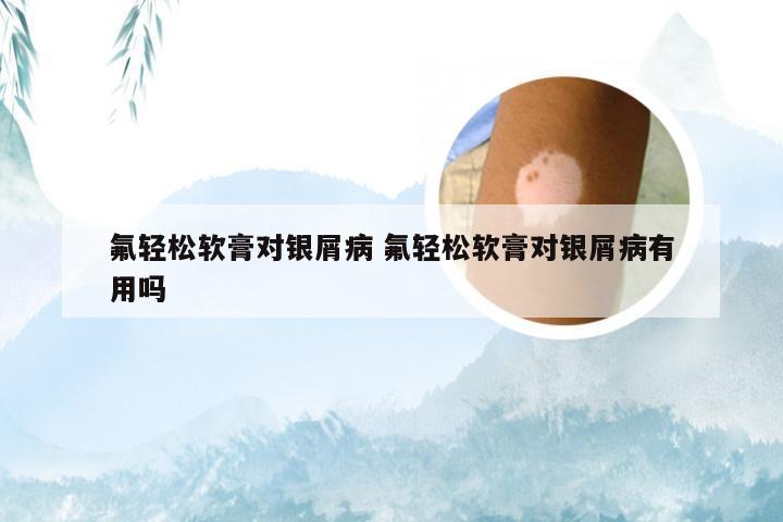氟轻松软膏对银屑病 氟轻松软膏对银屑病有用吗