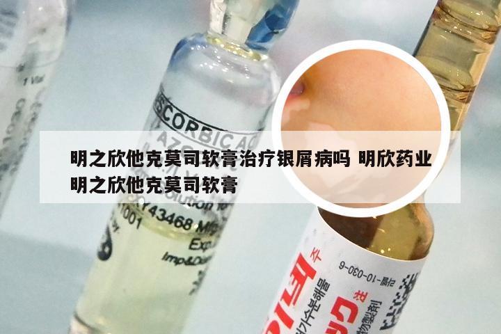 明之欣他克莫司软膏治疗银屑病吗 明欣药业明之欣他克莫司软膏