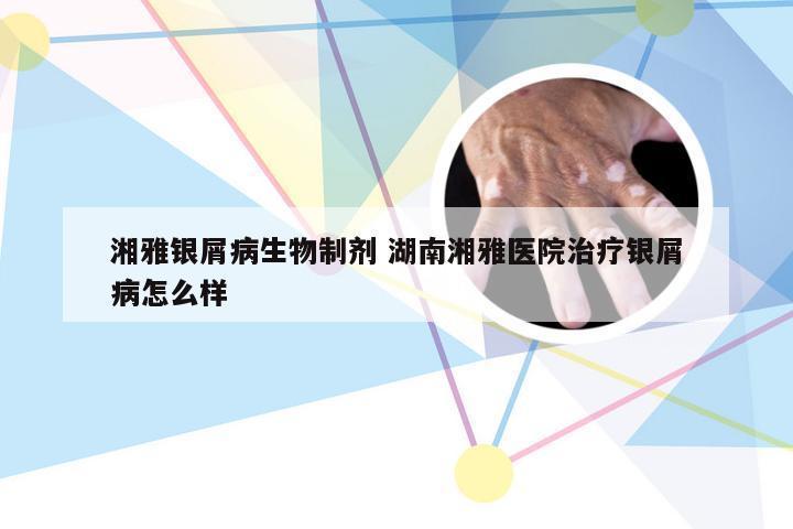 湘雅银屑病生物制剂 湖南湘雅医院治疗银屑病怎么样