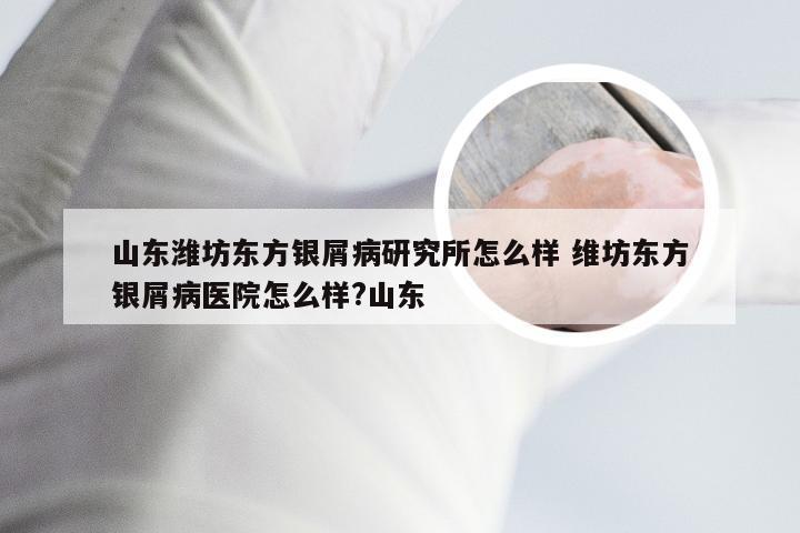 山东潍坊东方银屑病研究所怎么样 维坊东方银屑病医院怎么样?山东