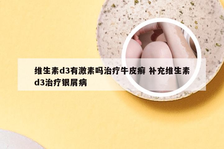 维生素d3有激素吗治疗牛皮癣 补充维生素d3治疗银屑病