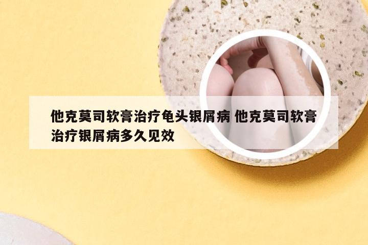 他克莫司软膏治疗龟头银屑病 他克莫司软膏治疗银屑病多久见效