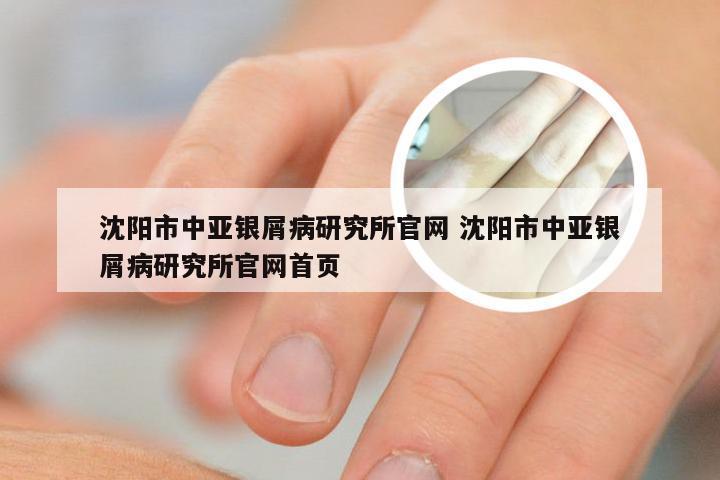 沈阳市中亚银屑病研究所官网 沈阳市中亚银屑病研究所官网首页