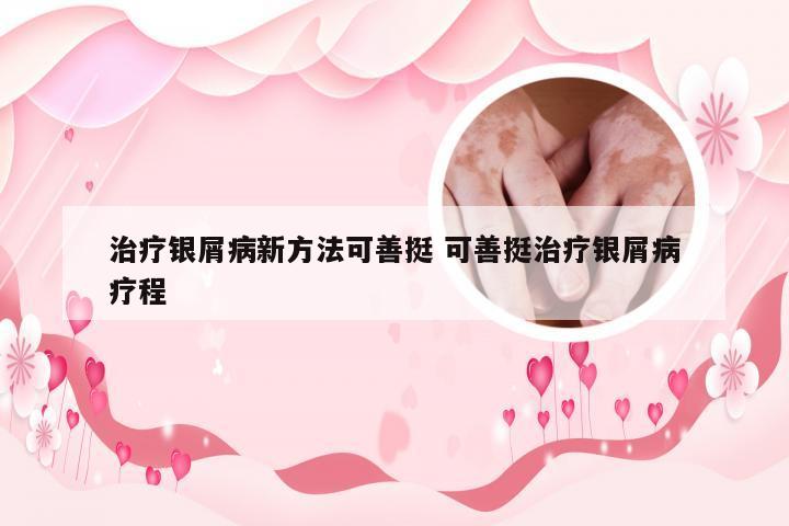 治疗银屑病新方法可善挺 可善挺治疗银屑病疗程