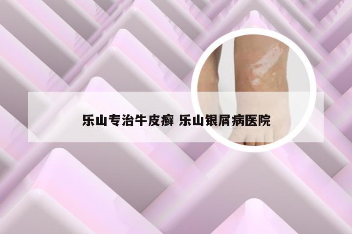 乐山专治牛皮癣 乐山银屑病医院