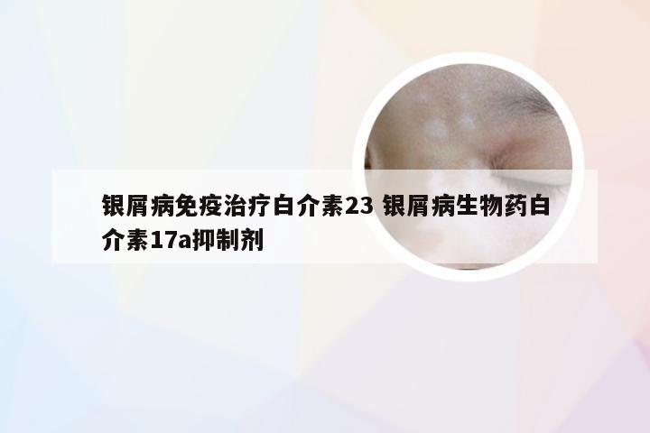 银屑病免疫治疗白介素23 银屑病生物药白介素17a抑制剂