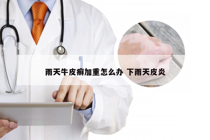 雨天牛皮癣加重怎么办 下雨天皮炎