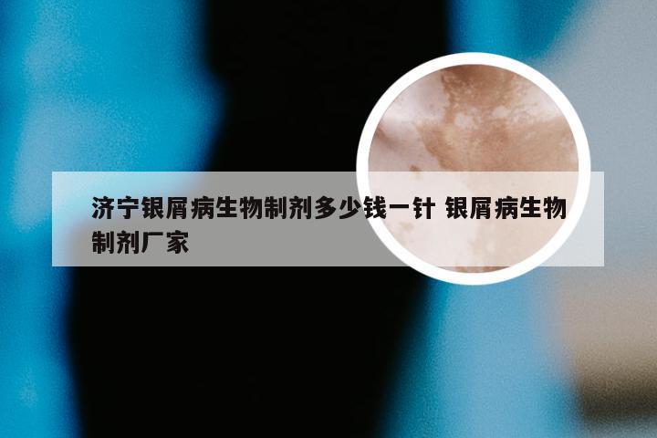 济宁银屑病生物制剂多少钱一针 银屑病生物制剂厂家