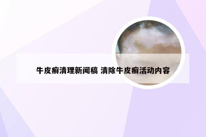 牛皮癣清理新闻稿 清除牛皮癣活动内容