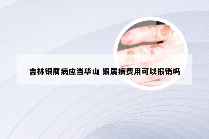 吉林银屑病应当华山 银屑病费用可以报销吗