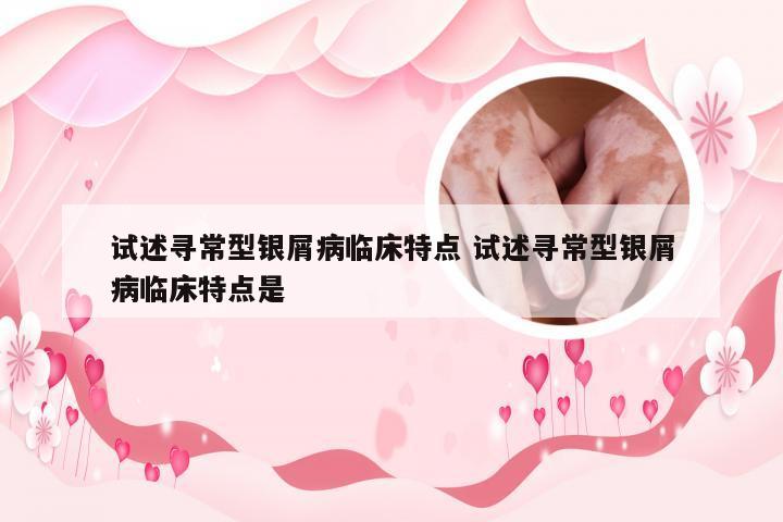试述寻常型银屑病临床特点 试述寻常型银屑病临床特点是
