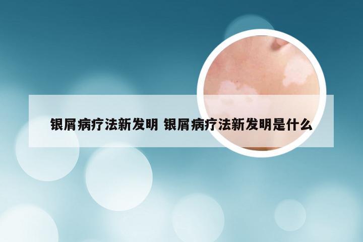 银屑病疗法新发明 银屑病疗法新发明是什么