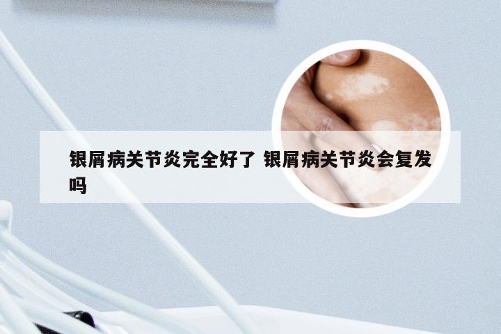 银屑病关节炎完全好了 银屑病关节炎会复发吗