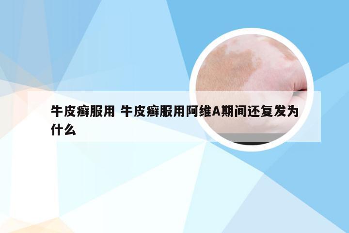 牛皮癣服用 牛皮癣服用阿维A期间还复发为什么