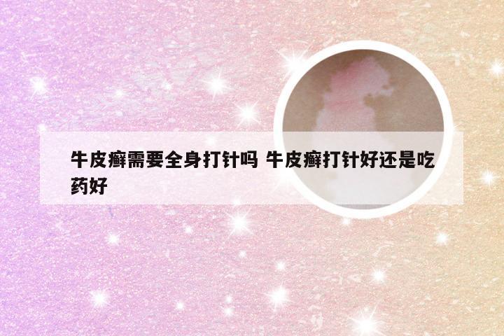 牛皮癣需要全身打针吗 牛皮癣打针好还是吃药好
